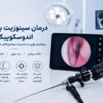 Sinuses endoscopy